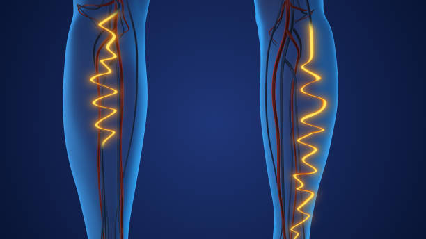Peripheral Intervention Procedures